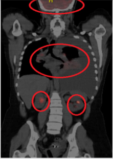 biomedres-openaccess-journal-bjstr