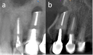biomedres-openaccess-journal-bjstr