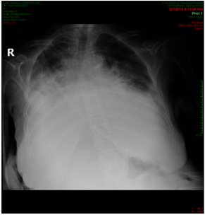 biomedres-openaccess-journal-bjstr