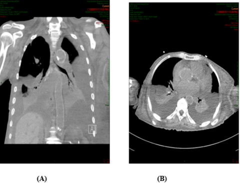 biomedres-openaccess-journal-bjstr