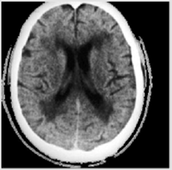biomedres-openaccess-journal-bjstr