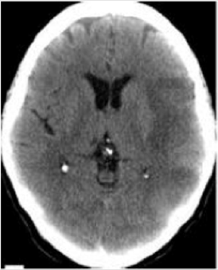 biomedres-openaccess-journal-bjstr