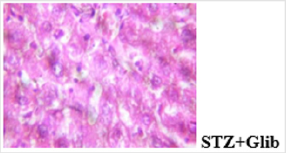 biomedres-openaccess-journal-bjstr