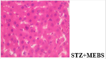 biomedres-openaccess-journal-bjstr