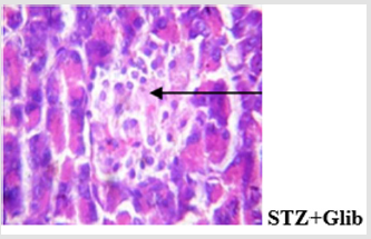 biomedres-openaccess-journal-bjstr