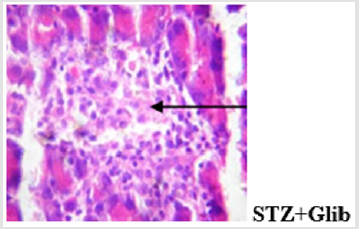 biomedres-openaccess-journal-bjstr