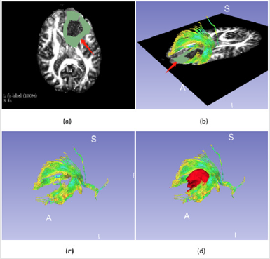 biomedres-openaccess-journal-bjstr