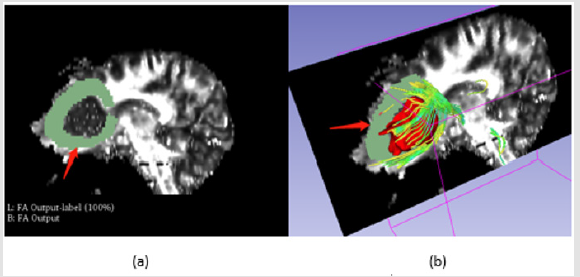 biomedres-openaccess-journal-bjstr