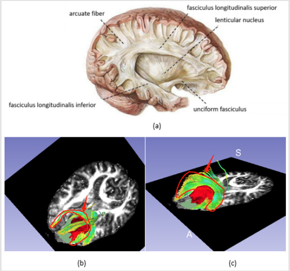 biomedres-openaccess-journal-bjstr