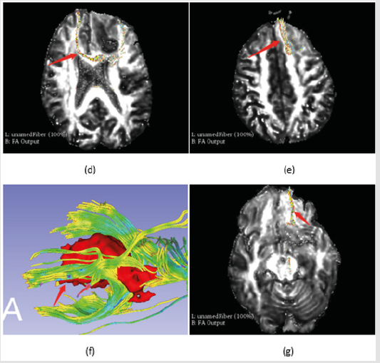 biomedres-openaccess-journal-bjstr