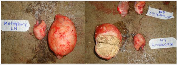 biomedres-openaccess-journal-bjstr