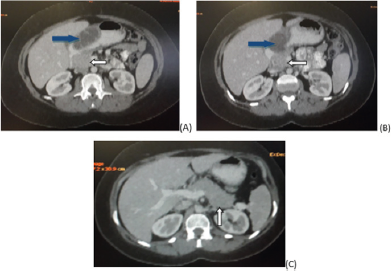 biomedres-openaccess-journal-bjstr
