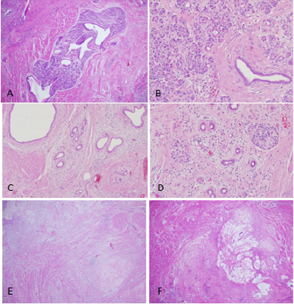biomedres-openaccess-journal-bjstr