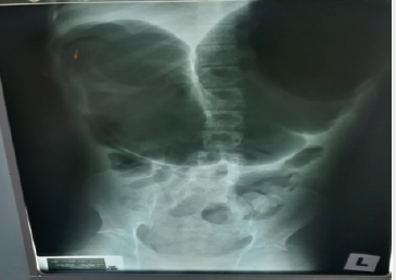 biomedres-openaccess-journal-bjstr