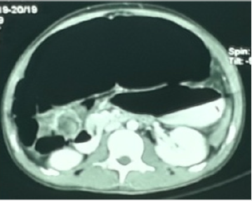 biomedres-openaccess-journal-bjstr