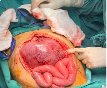 biomedres-openaccess-journal-bjstr