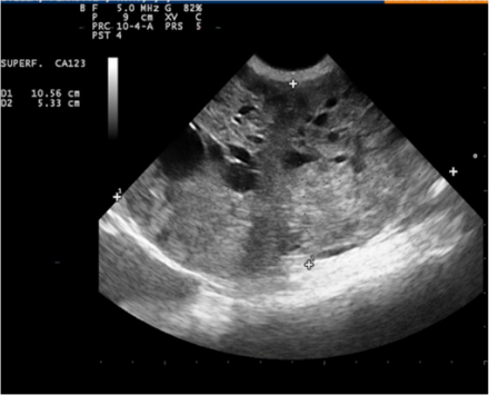 biomedres-openaccess-journal-bjstr