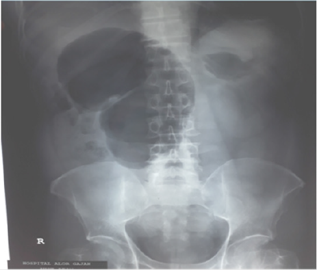 biomedres-openaccess-journal-bjstr