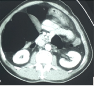 biomedres-openaccess-journal-bjstr