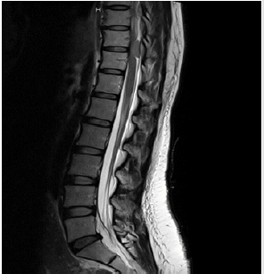 biomedres-openaccess-journal-bjstr
