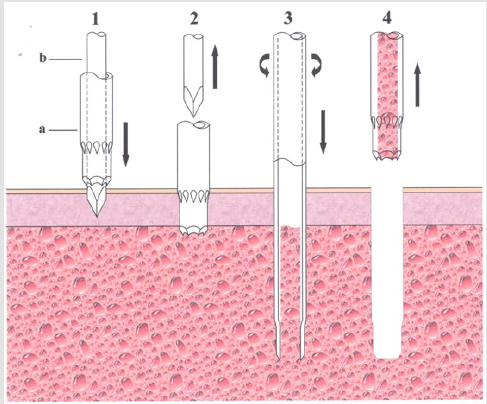 biomedres-openaccess-journal-bjstr