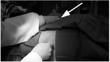 biomedres-openaccess-journal-bjstr