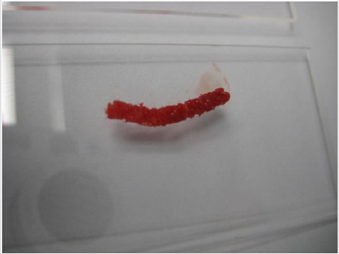 biomedres-openaccess-journal-bjstr