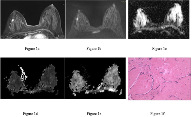biomedres-openaccess-journal-bjstr