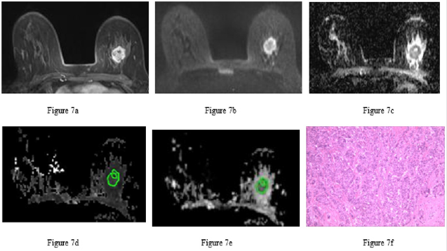 biomedres-openaccess-journal-bjstr