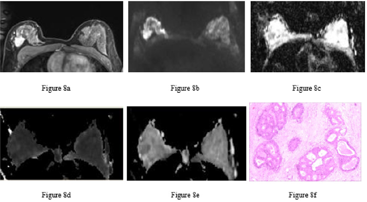biomedres-openaccess-journal-bjstr