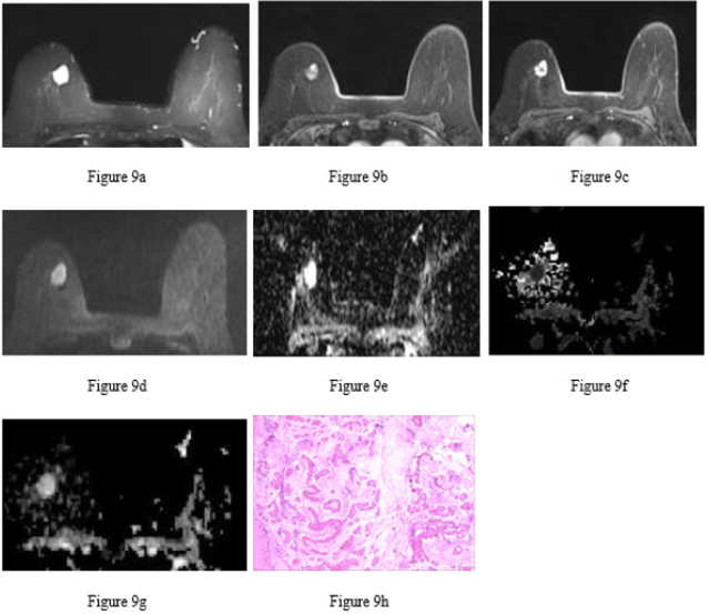 biomedres-openaccess-journal-bjstr