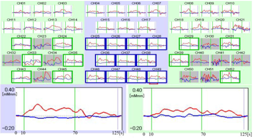 biomedres-openaccess-journal-bjstr
