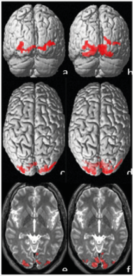 biomedres-openaccess-journal-bjstr