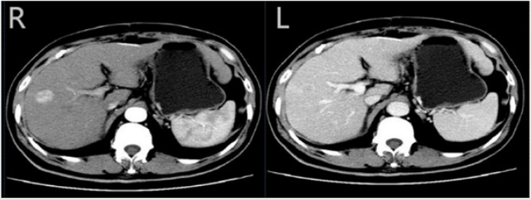 biomedres-openaccess-journal-bjstr
