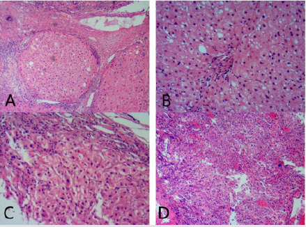 biomedres-openaccess-journal-bjstr