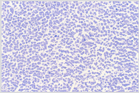 biomedres-openaccess-journal-bjstr