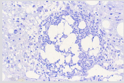 biomedres-openaccess-journal-bjstr