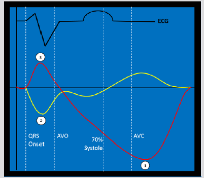 biomedres-openaccess-journal-bjstr