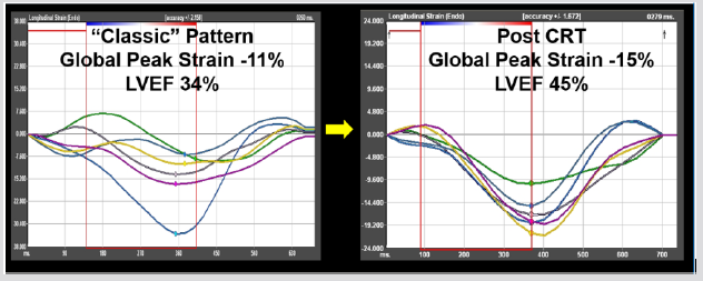 biomedres-openaccess-journal-bjstr