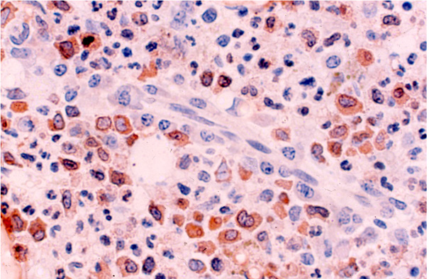 biomedres-openaccess-journal-bjstr