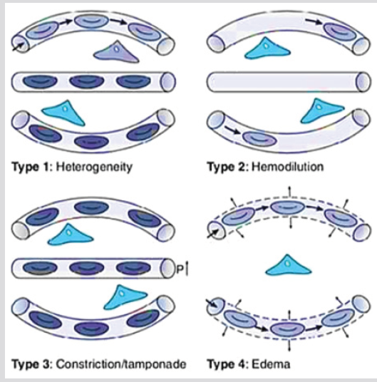 biomedres-openaccess-journal-bjstr