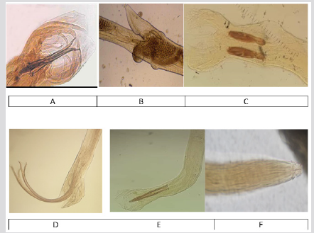 biomedres-openaccess-journal-bjstr