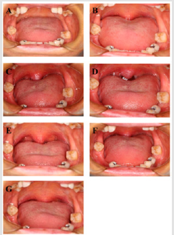 biomedres-openaccess-journal-bjstr
