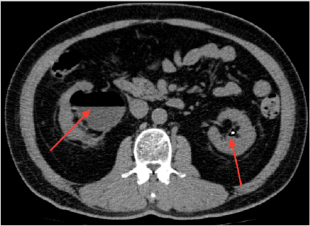 biomedres-openaccess-journal-bjstr