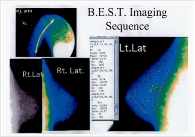biomedres-openaccess-journal-bjstr