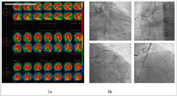 biomedres-openaccess-journal-bjstr