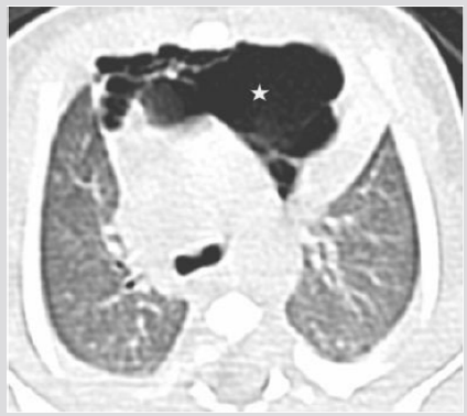 biomedres-openaccess-journal-bjstr