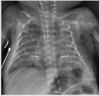 biomedres-openaccess-journal-bjstr