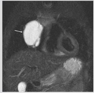 biomedres-openaccess-journal-bjstr