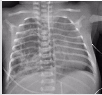 biomedres-openaccess-journal-bjstr